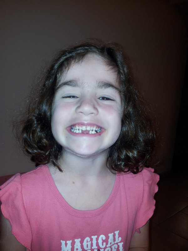 teeth